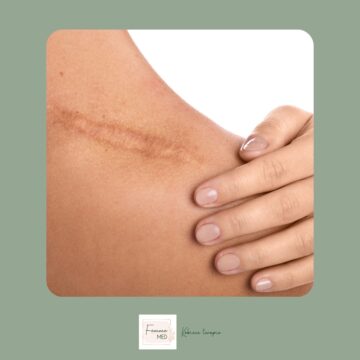 terapia blizny